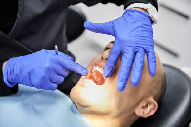 Best Knocked-Out Tooth (Avulsed Tooth) Treatment in Lebanon, KY